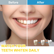 Load image into Gallery viewer, Teeth Whitening Kit for Sensitive Teeth, Includes LED Light